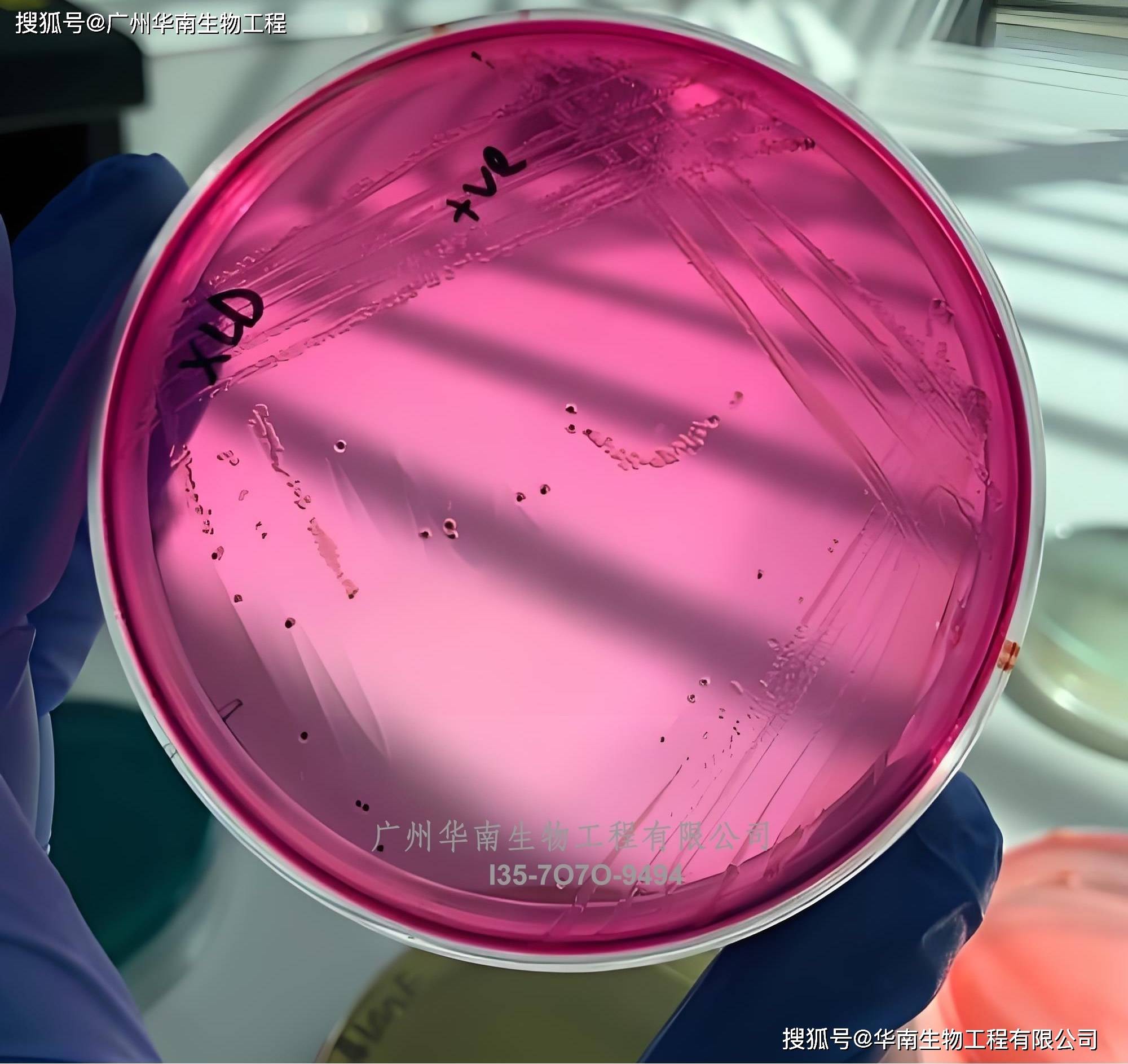 丹(dān)麦ssi中国官网中文版